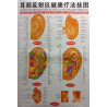 Ear Meridians & Acu-Points Chart